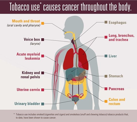 tobacco cancer