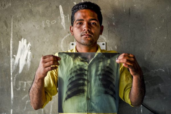 India most TB cases